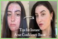 How To Feel Confident With Acne?